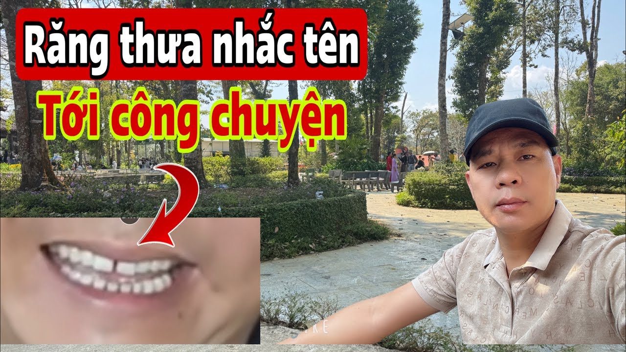 Biến căng 🎀răng thưa chịu gọi tên
