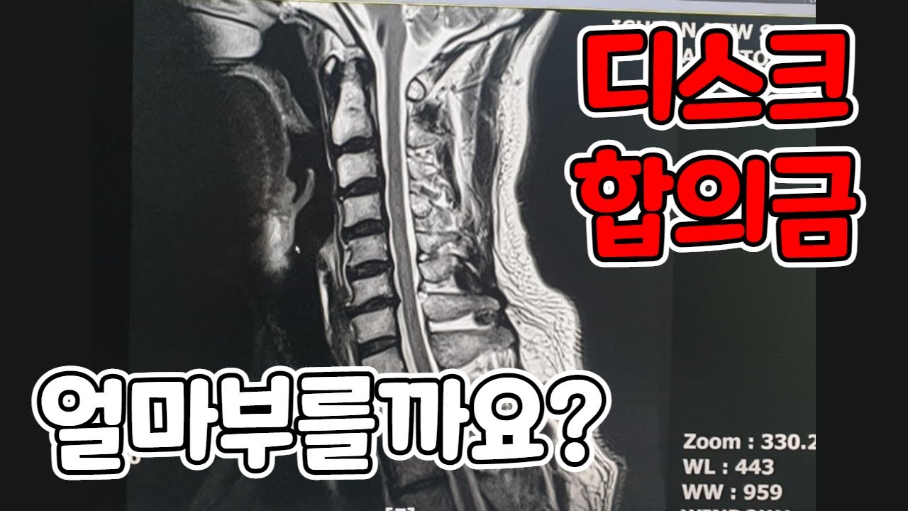 교통사고 디스크 사고기여도를 안적어줄때?(426회)