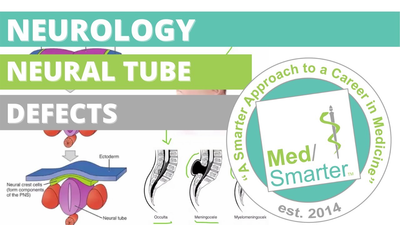 USMLE Step 1 | Neurology: Neural Tube Defects