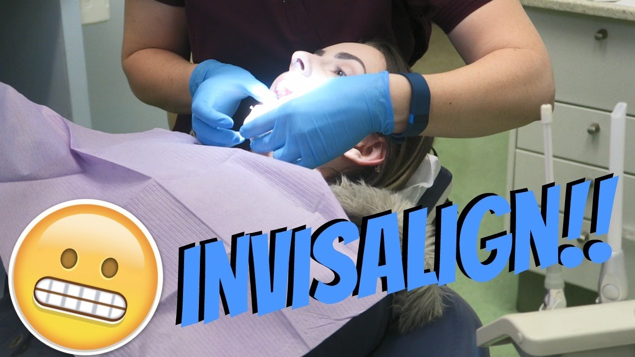 Finally Started My Invisalign!!