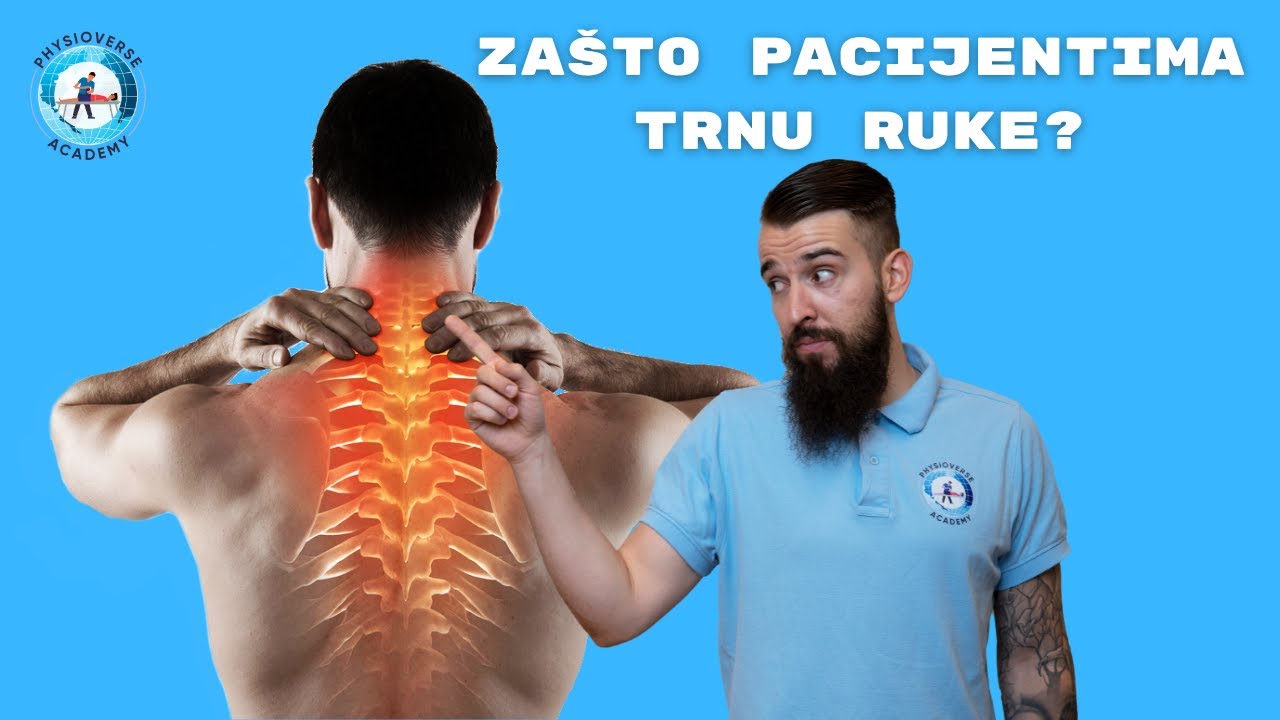 Što je Cervikobrahijalni sindrom i kako nastaje?