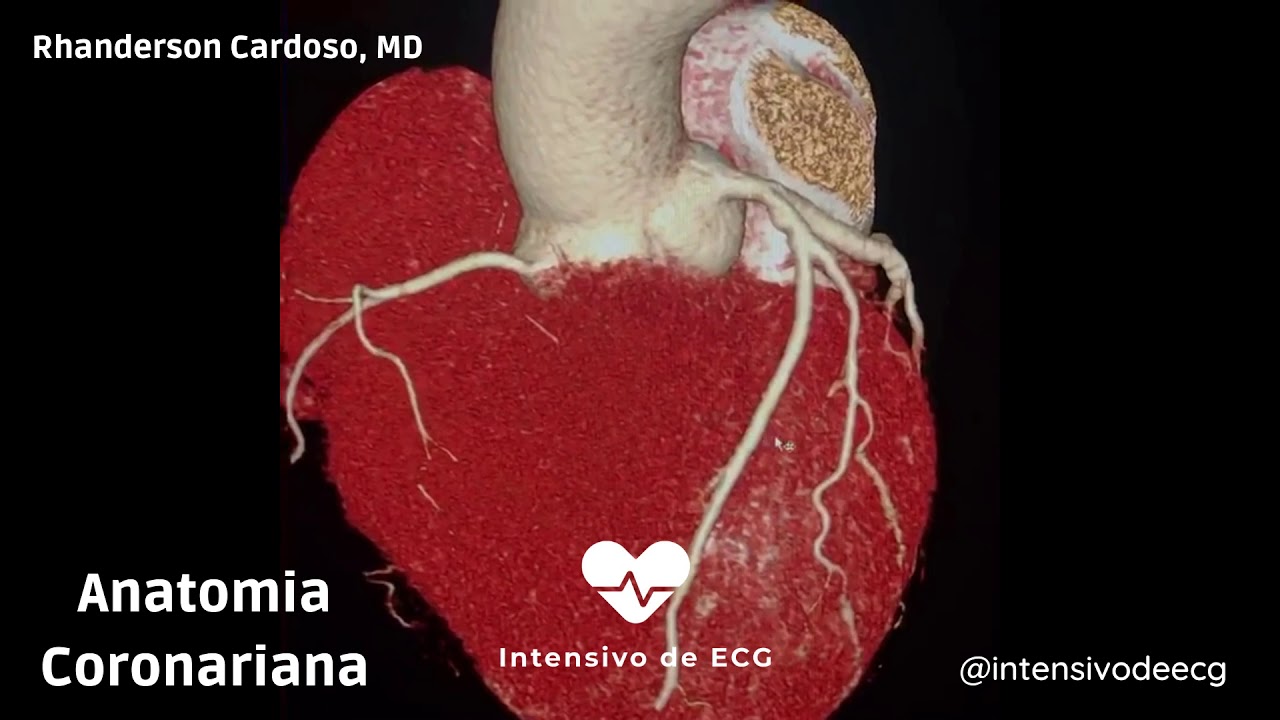 Anatomia Coronariana - Aprenda com uma angiotomografia em 3D