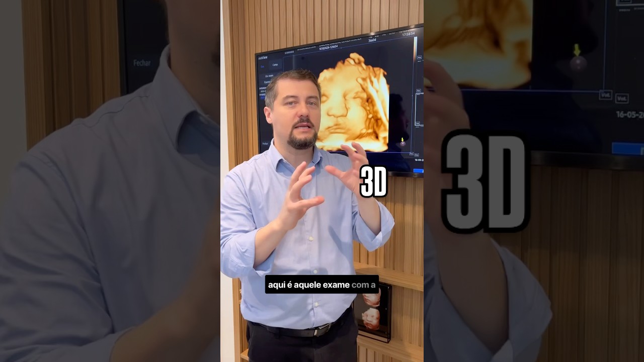 Qual a diferen&ccedil;a entre ultrassom 3D 4D e 5D ? #ultrassom #ultrassonografia