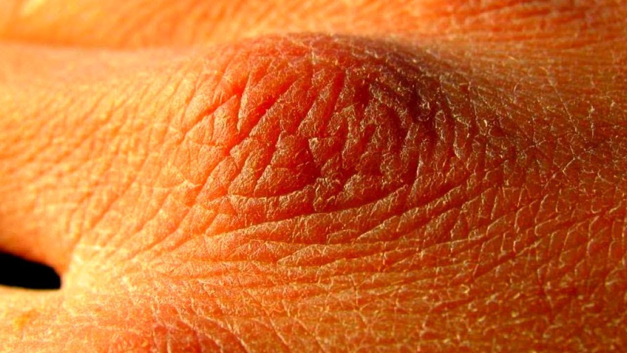 جميع العلامات التي تدل على أنك لا تشرب كمية كافية من الماء