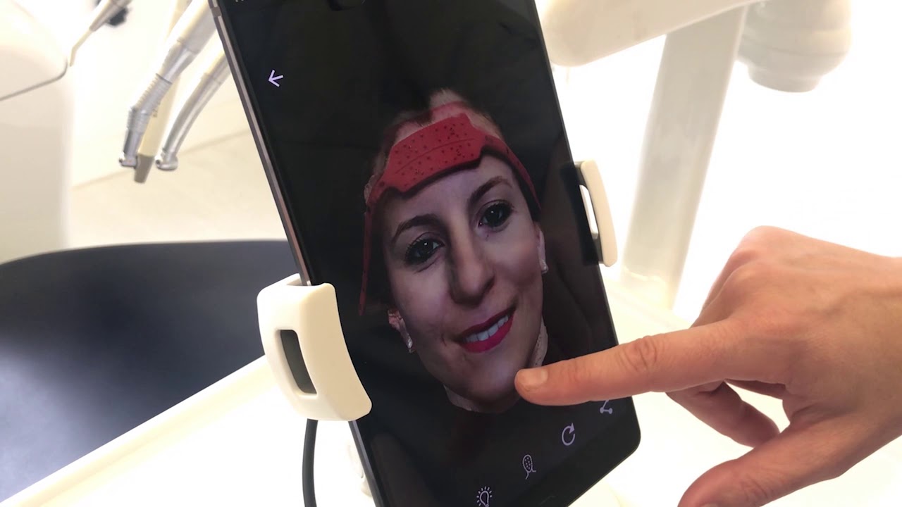 👽Esc&aacute;ner facial 3D Alucinante para Dentistas