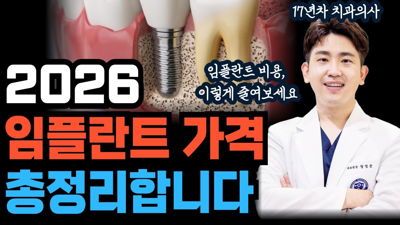 2026 임플란트 가격 총정리ㅣ임플란트 비용 절감, 요새는 이렇게 합니다 #풀아치