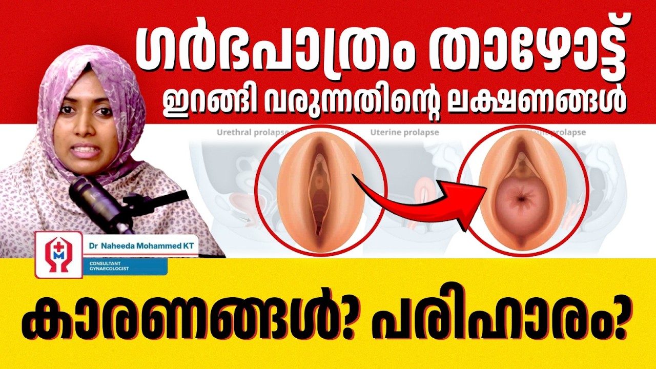 ഗർഭപാത്രം താഴോട്ടിറങ്ങി വരുന്നതിന്റെ ലക്ഷണങ്ങൾ പരിഹാരം