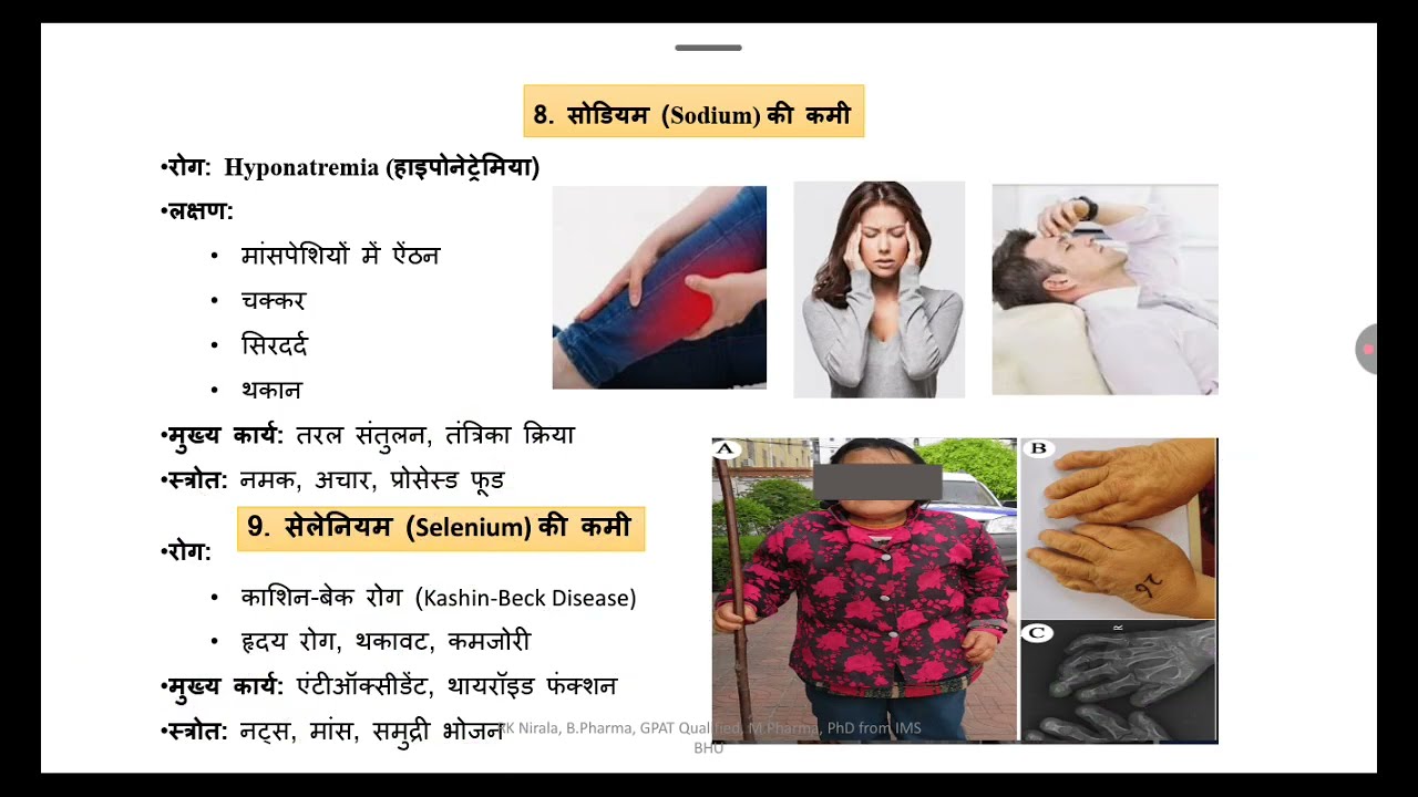 खनिज की कमी  से  होने  वाले  रोग 