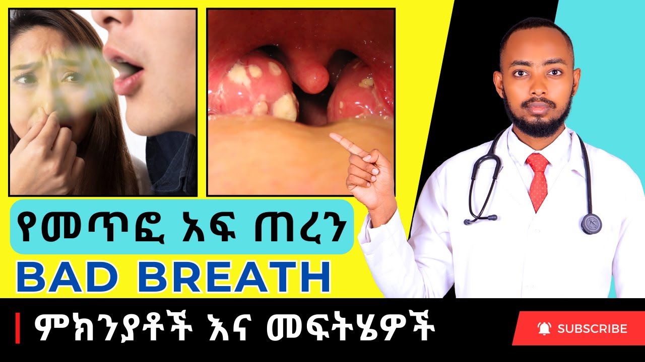 Ethiopia | የመጥፎ አፍ ጠረን ምክንያቶች እና መፍትሄዎች / Bad Breath (Halitosis)