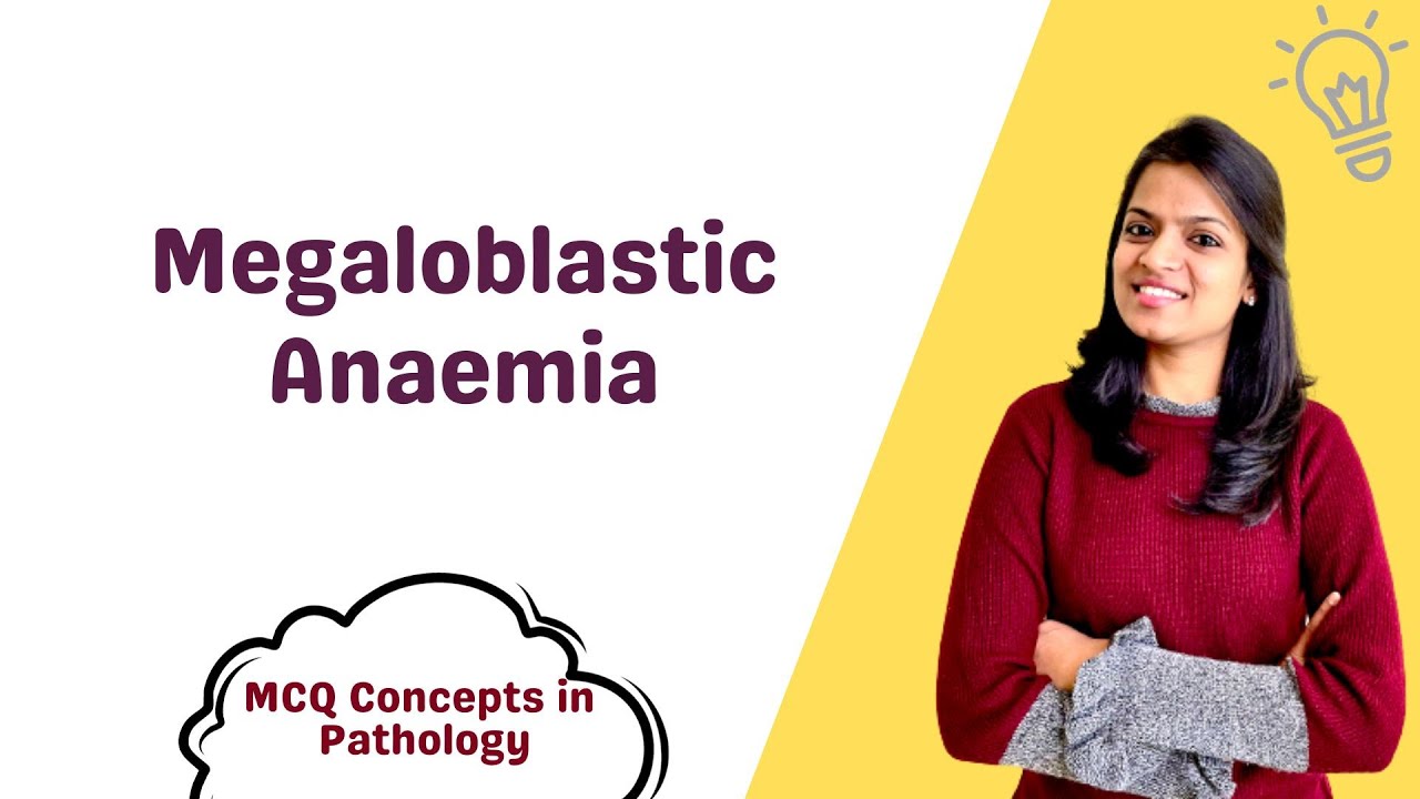 Megaloblastic Anaemia  - MCQ concepts