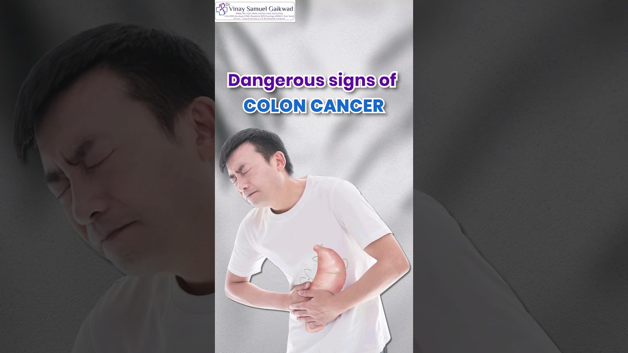 Deadly Signs of Colon Cancer #coloncancer #cancertreatment