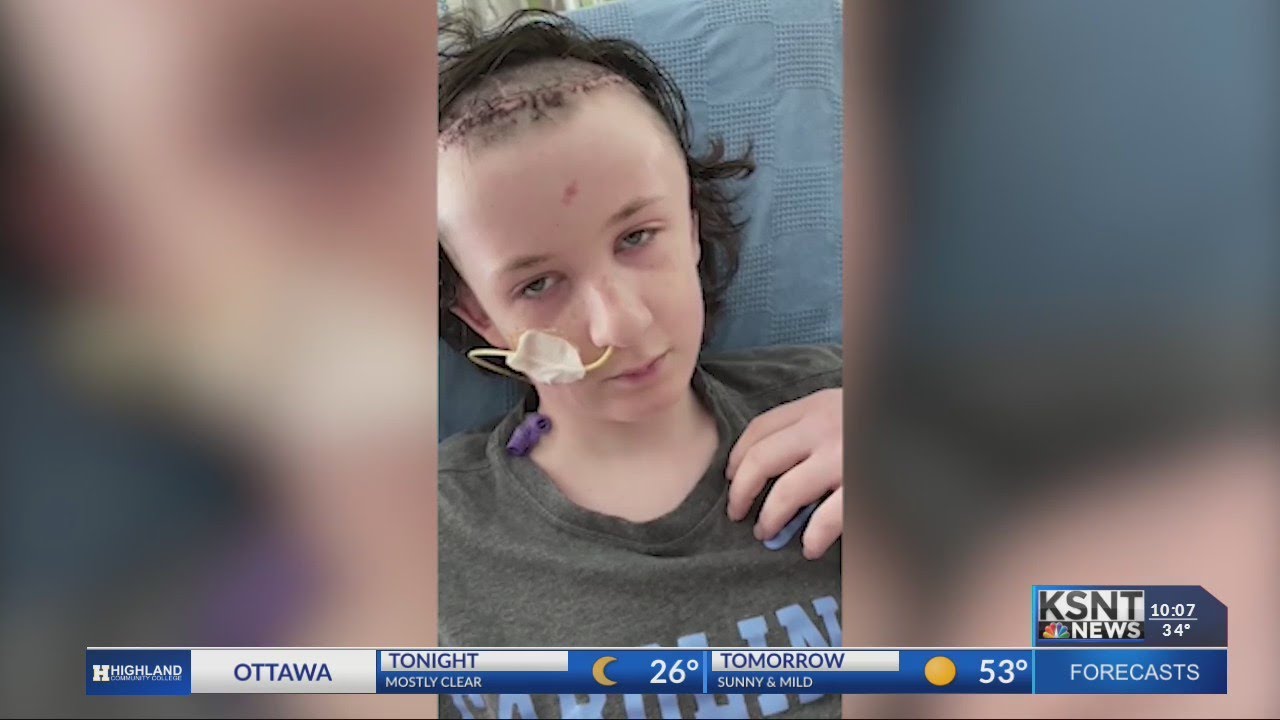 Holton boy injured from pellet gun speaks for first time since accident