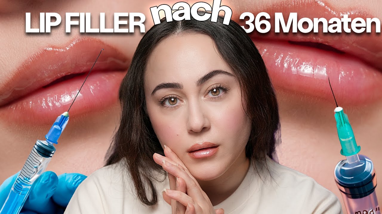 Meine Lip Filler?! 36 Monaten später ... Lip Filler, Lip Flip und Lift ...