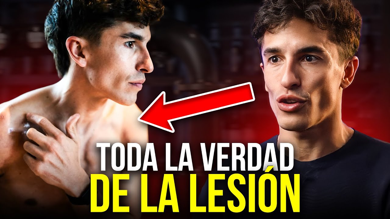 Márquez: "Sólo mis médicos y yo sabemos lo que hay en el brazo" | Rueda de prensa de Marc