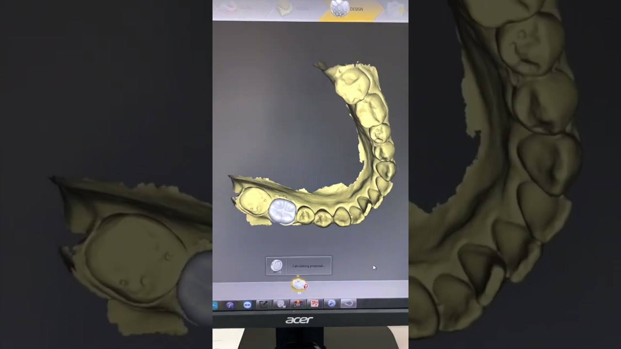 Make A Digital Dental Crown 👑#cadcam #cadcamdentistry #cerec #smilemakeover #sirona #emax #dentist