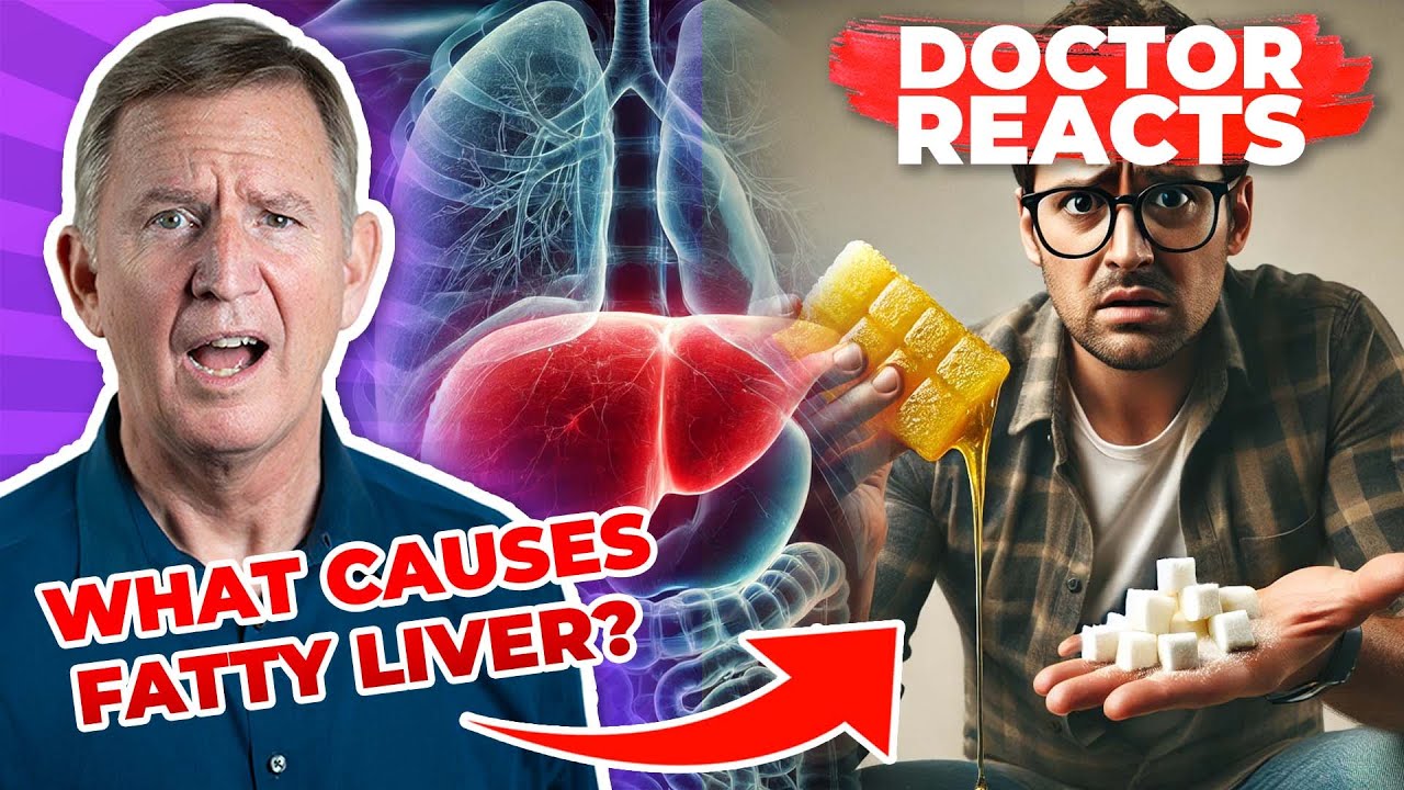 The #1 Cause of Visceral Fat and Fatty Liver is NOT Sugar? - Doctor Reacts