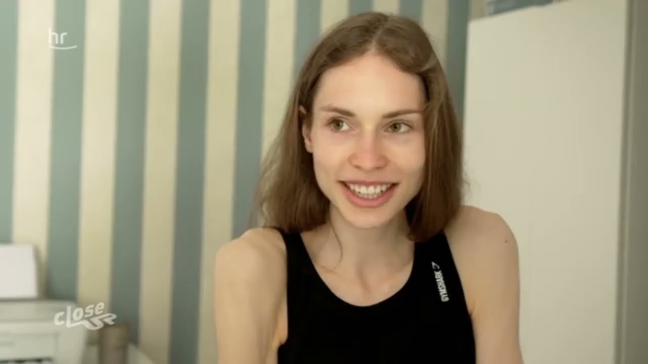 Wegen meiner Essstörung sitze ich auf den Knochen