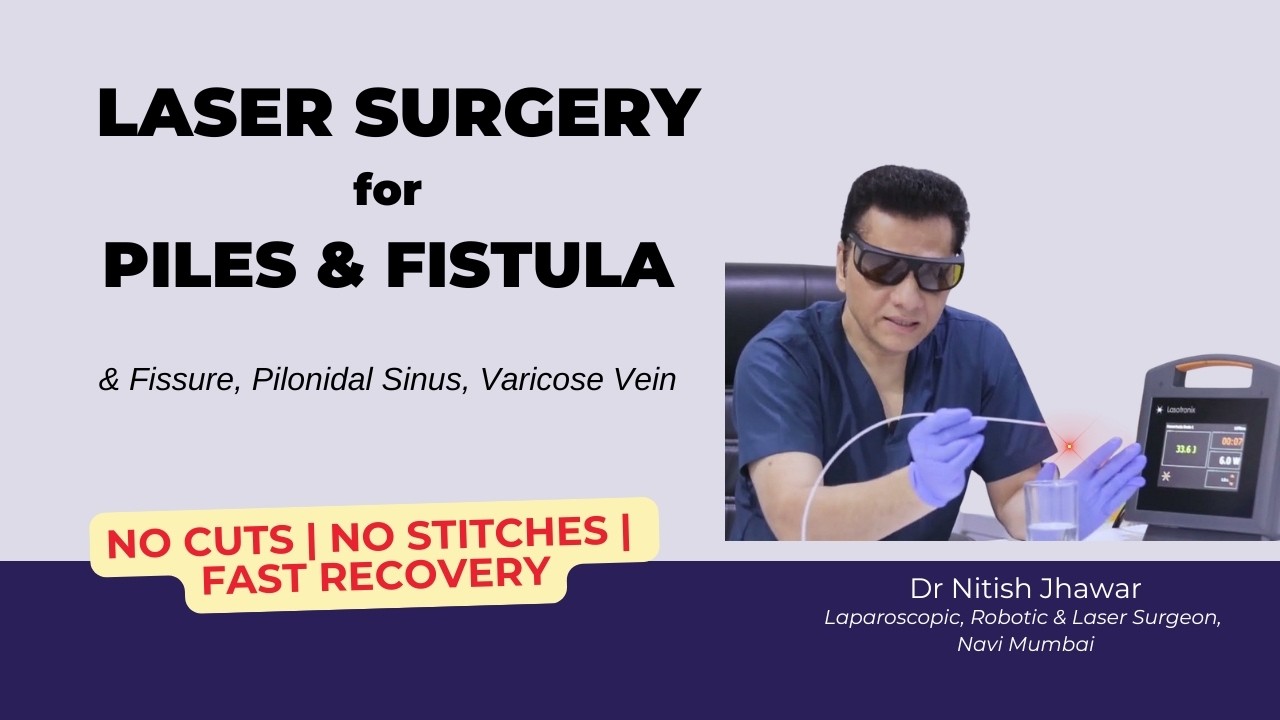 Laser Surgery Piles Fissure Fistula Pilonidal Sinus Varicose Vein बवासीर फ़िशर फ़िस्चुला लेजर सर्जरी