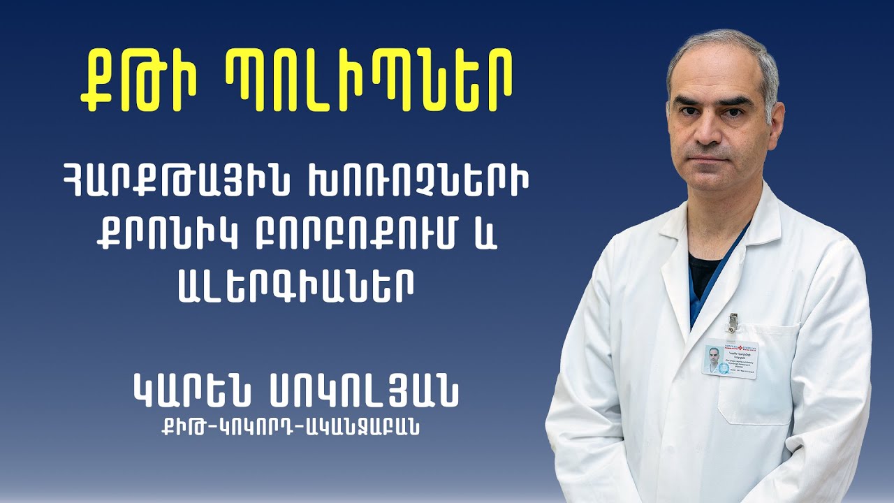 Քթի պոլիպներ, դժվար շնչառություն․ Քիթ-կոկորդ-ականջաբան Կարեն Սոկոլյան
