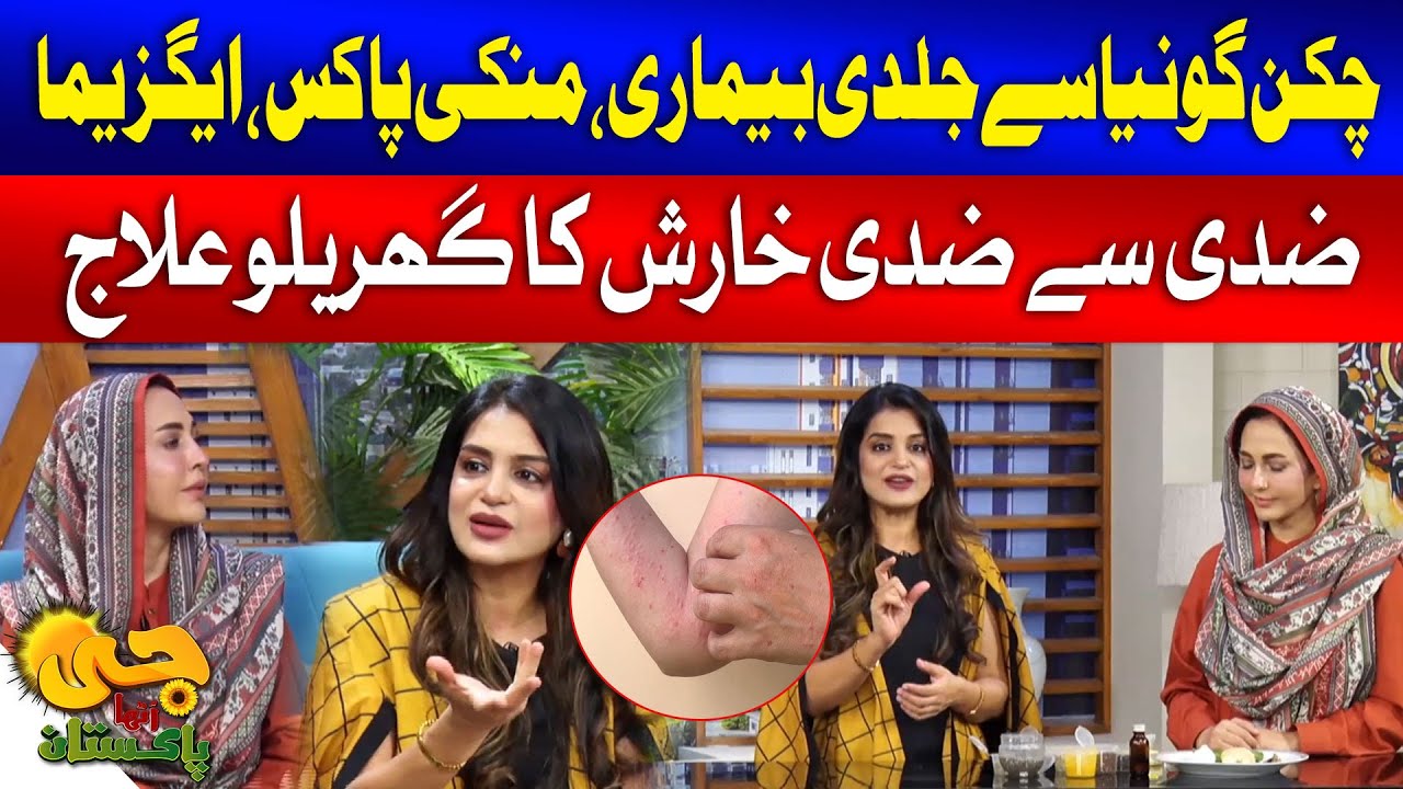 Home remedies for skin allergy and itching | Dr Umme Raheel | G Utha Pakistan