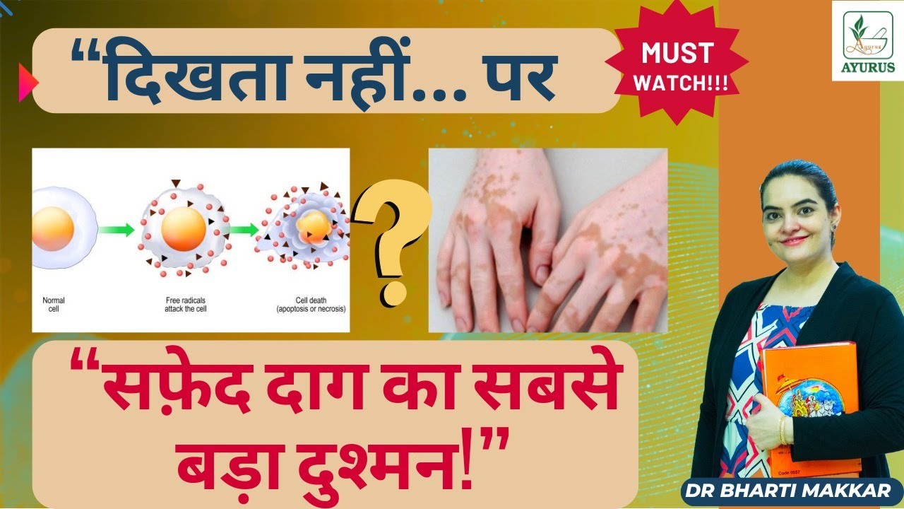 The Real Villain Behind White Patches (Vitiligo Explained) | Dr. Bhari Makkar