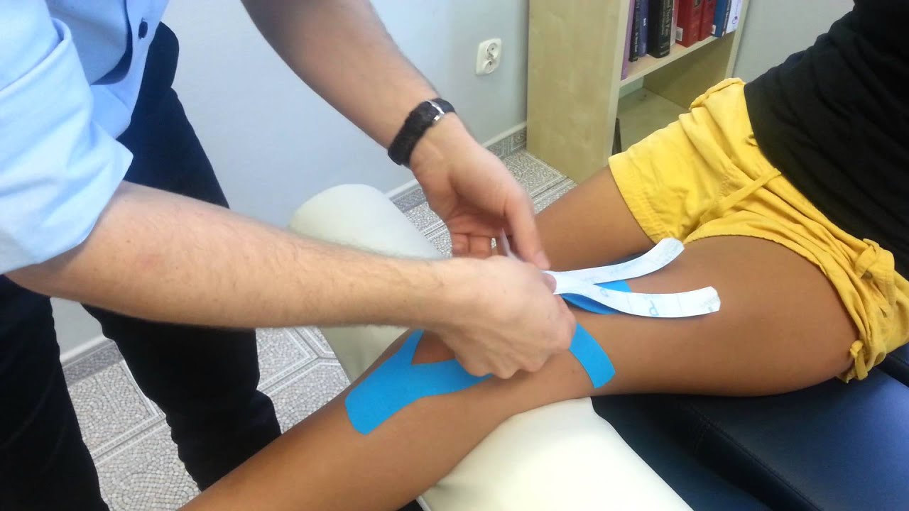 Taping kolana - stabilizacja rzepki