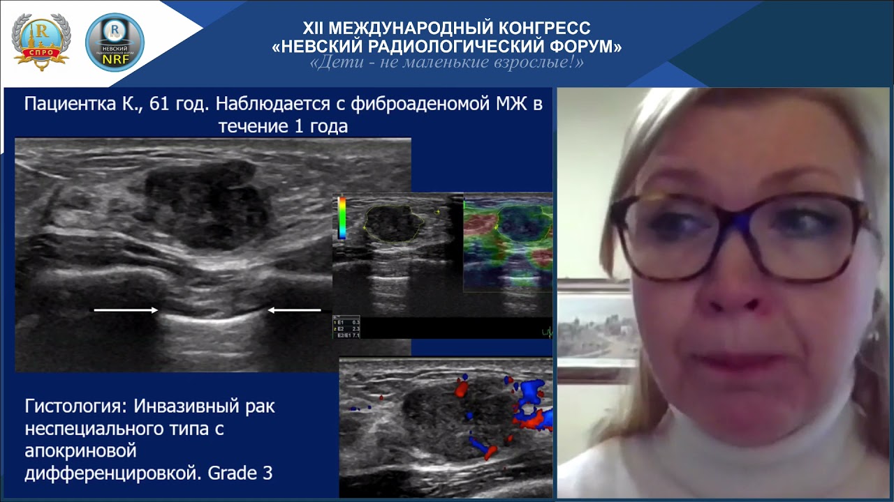 НАУЧНАЯ ШКОЛА «Мультидисциплинарный подход к диагностике необъемных изменений молочных желез»