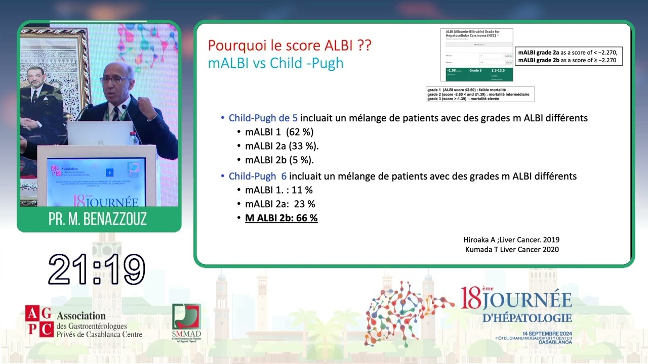 Traitement systémique du carcinome hépatocellulaire sur cirrhoseen 2024 - Pr M. Benazzouz