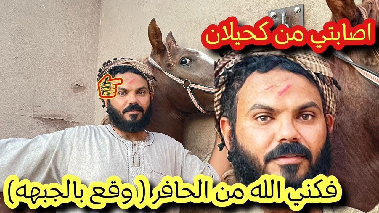 إصابة حافر بنص الجبهه🤕💔كشف سونار ( سمحه وعنبر ) 🐎😍