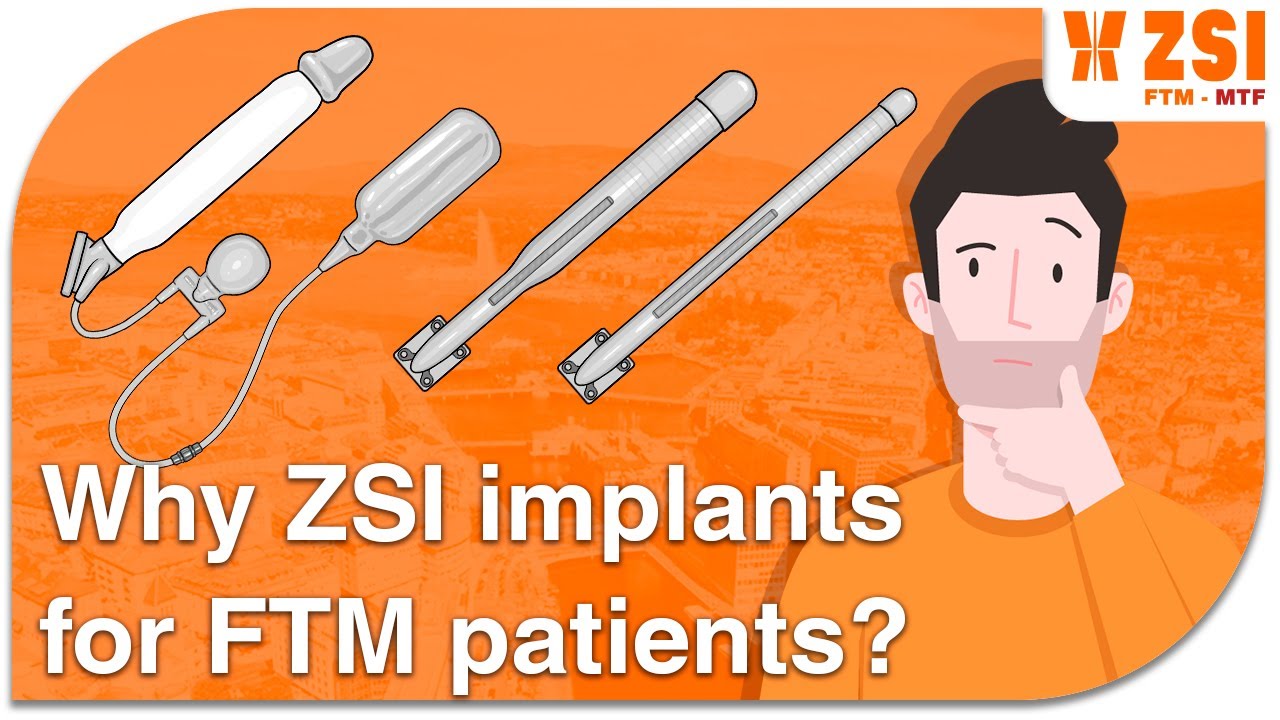 Why ZSI implants for FTM patients?