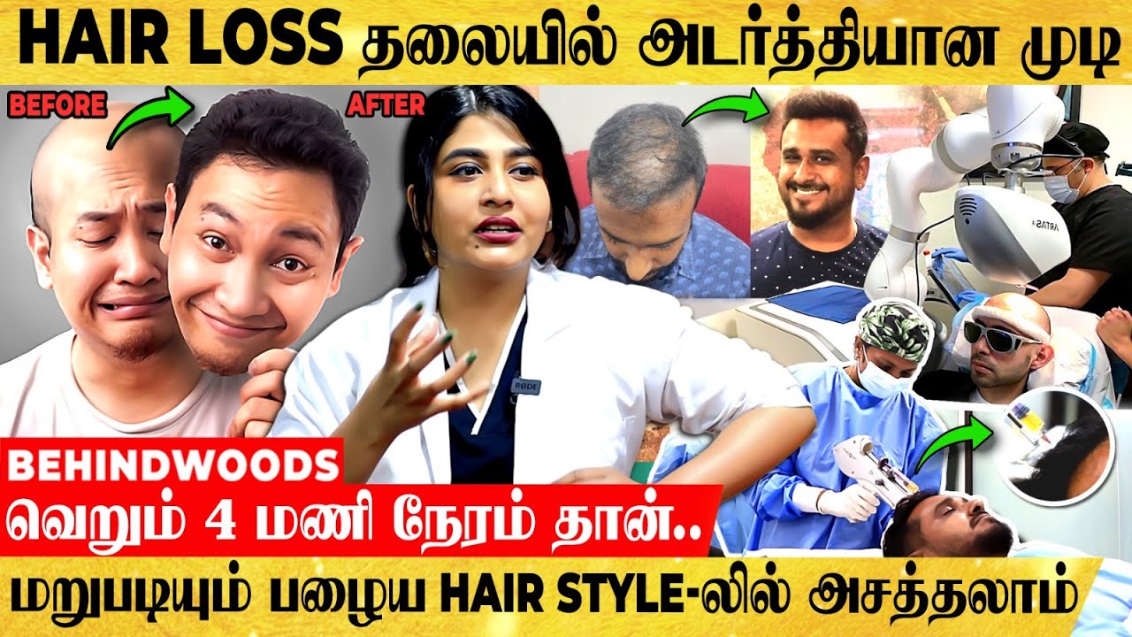 வெறும் 4 மணி நேரம் தான்.. Hair Transplant -ல் ஆளையே அசத்தலாக மாத்திட்டாங்க..!