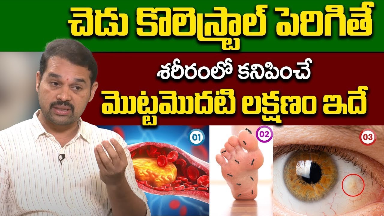 ప్రాణాలు తీసేస్తుంది జాగ్రత్త : Symptoms of High Cholesterol: Causes, Side Effects | Dr Delip Kumar