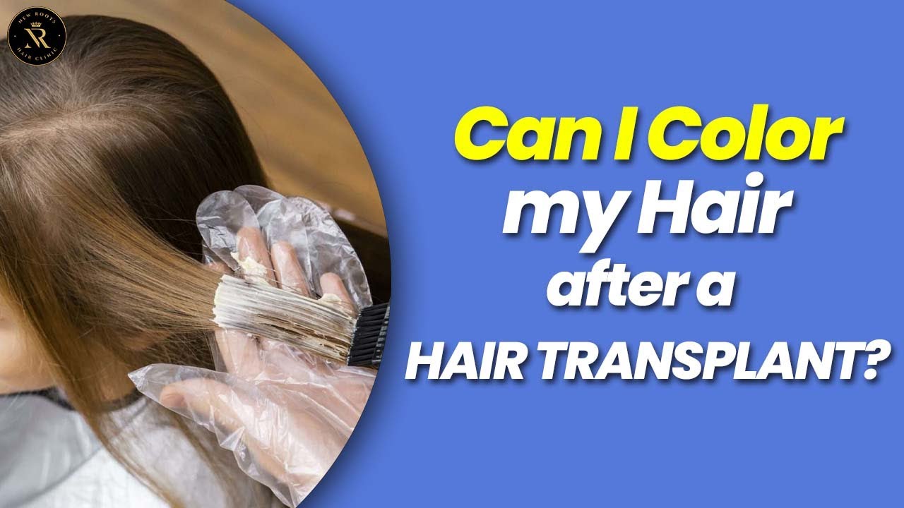 How To Colour Your Hair After Hair Transplant ?