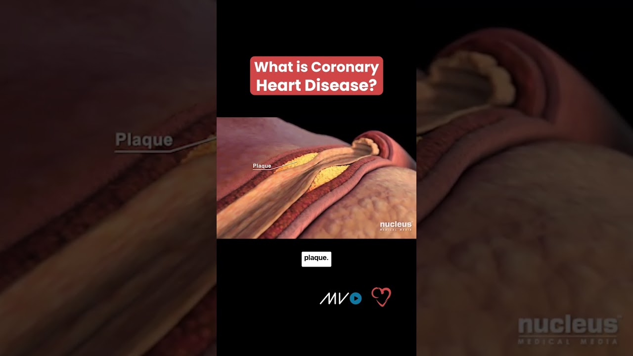 What is Heart Disease?