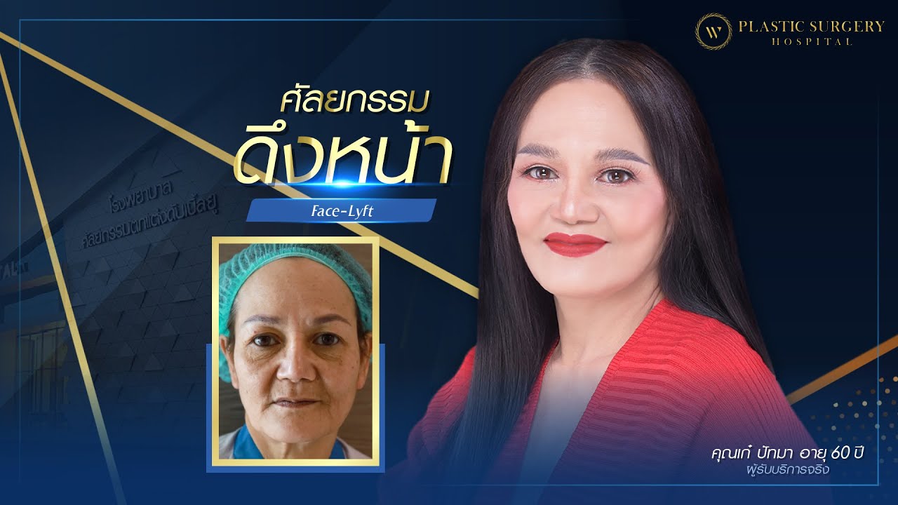 หน้าเด็กลง กรอบหน้าชัด สวย…ย้อนวัย ‼ ผลลัพธ์ 21 วัน หลังดึงหน้า ของคุณเก๋ ปัทมา