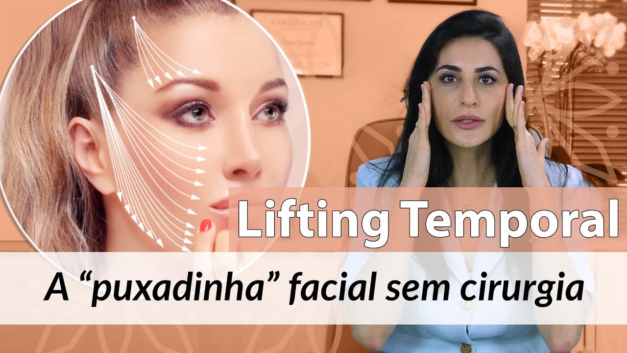 Lifting Temporal - A técnica de levantamento do rosto sem cirurgia plástica