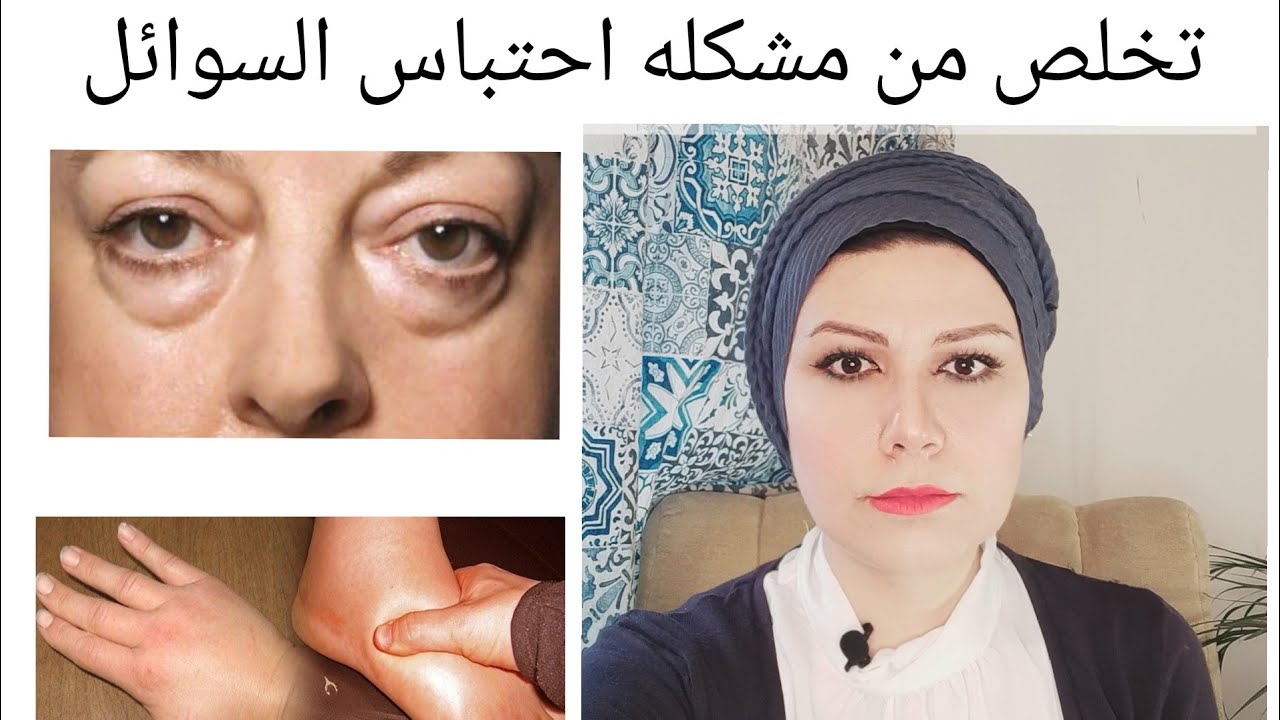 تخلص من مشكله احتباس السوائل، احمي نفسك من ضغط الدم المرتفع.