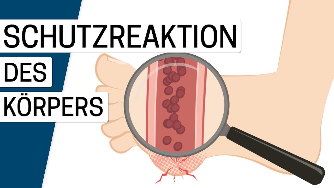 Was ist eine Entzündung?