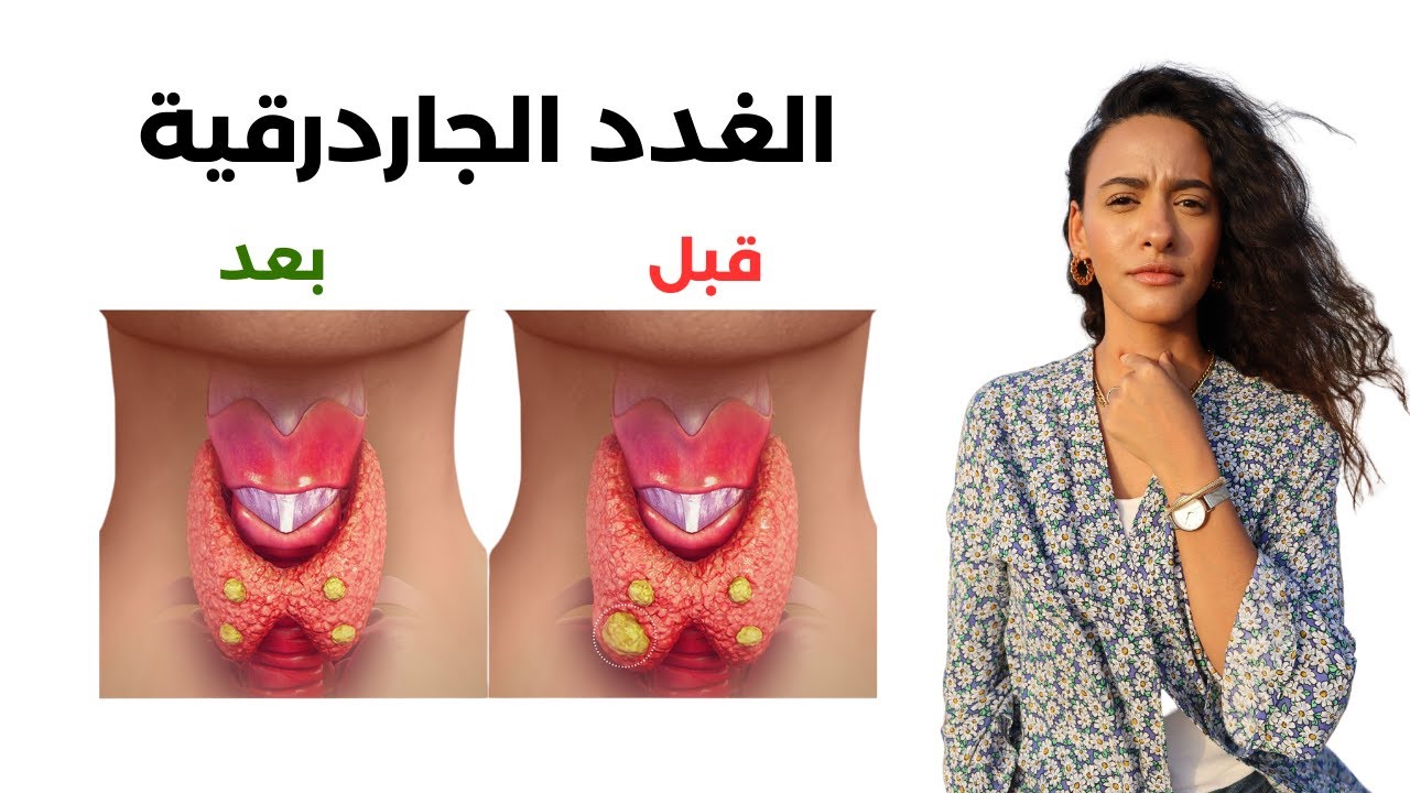 أعراض تبدو عادية لكنها تدل على مشاكل الغدد الجار الدرقية