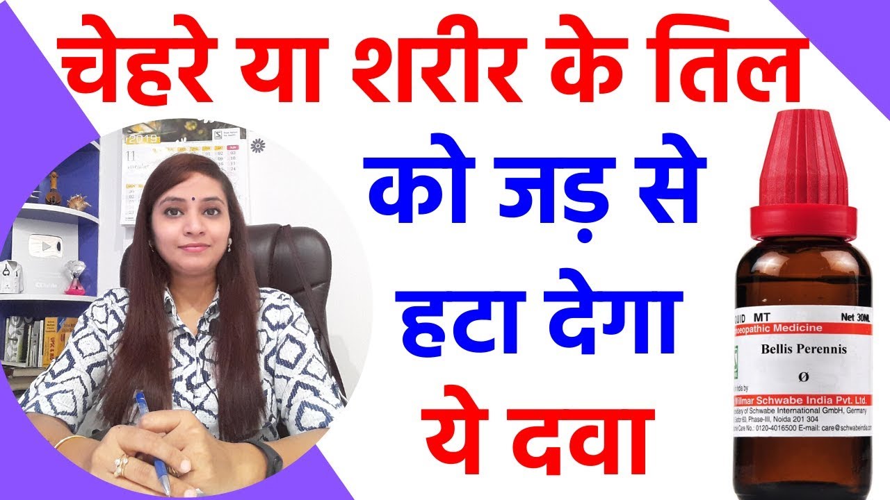 तिल हटाने का तरीका | तिल हटाने के उपाय | chehre ke til ka ilaj |तिल हटाने की दवा |तिल हटाने की क्रीम