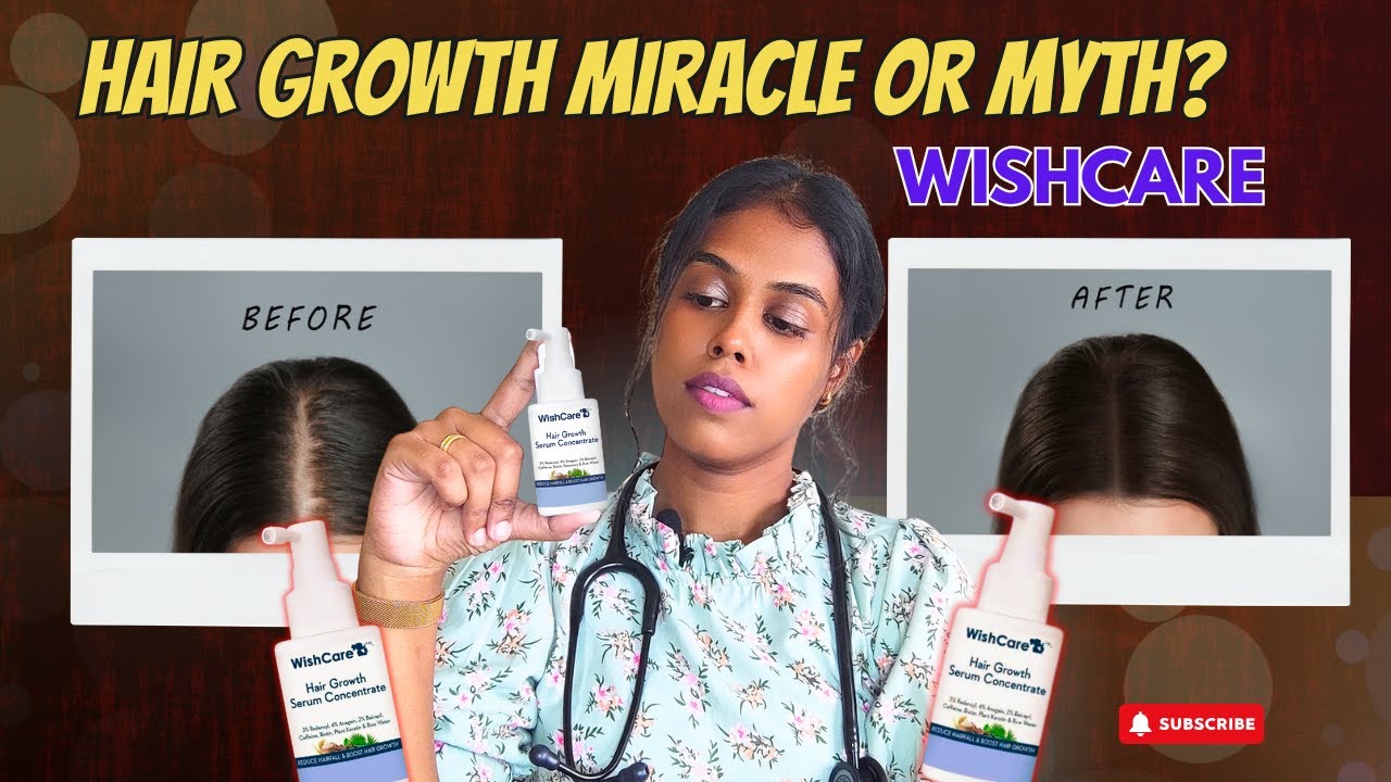 Wishcare Hair growth serum review by a Doctor | Wishcare serum in Tamil |  Dr. Jeni | #notsponsored