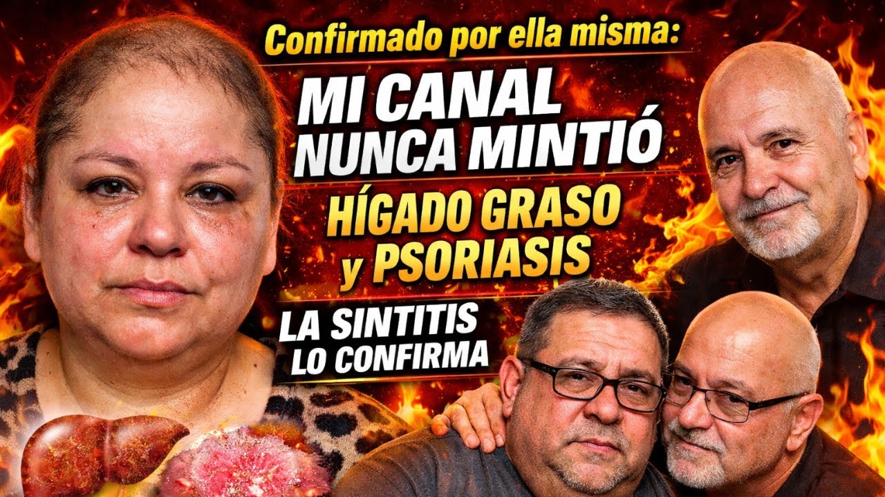 Confirmado por ella misma: mi canal nunca mintió, hígado graso y Psoriasis la sintitis lo confirma