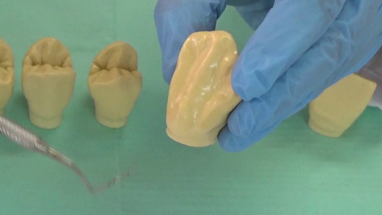 Morfología dentaria de las coronas superiores definitivas