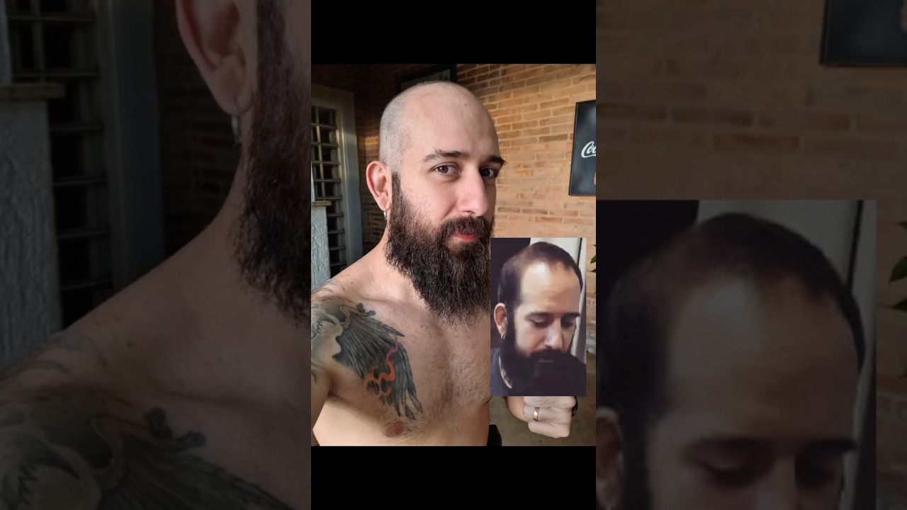 O Matheu virou um CARECA junto com a família.Que momento!! 
