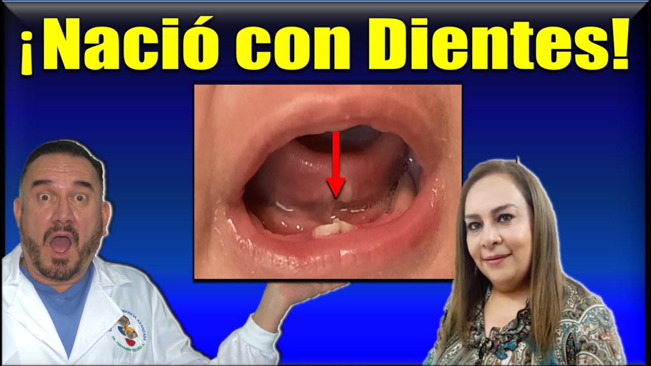 НАТАЛЬНЫЕ И НЕОНАТАЛЬНЫЕ ЗУБЫ (ВРОЖДЕННЫЕ, ВРОЖДЕННЫЕ, ПРЕНАТАЛЬНЫЕ, ПРЕНАТАЛЬНЫЕ ИЛИ РАННЕЕ)