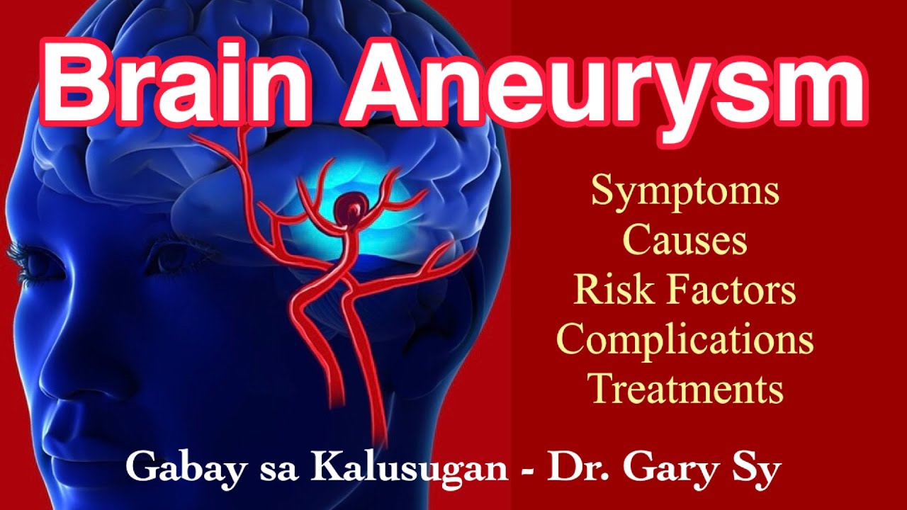 Brain Aneurysm - Dr. Gary Sy