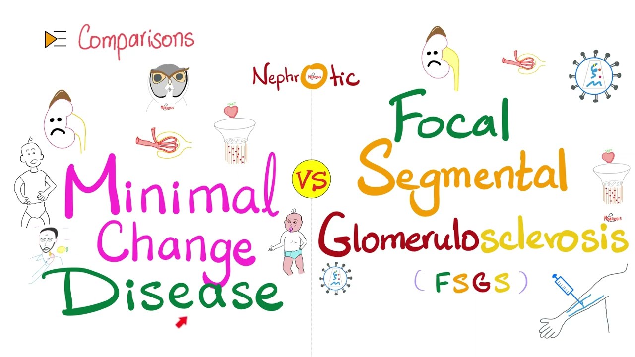 Minimal Change Disease (MCD) VS Focal Segmental Glomerulosclerosis (FSGS) | Nephrotic Syndrome