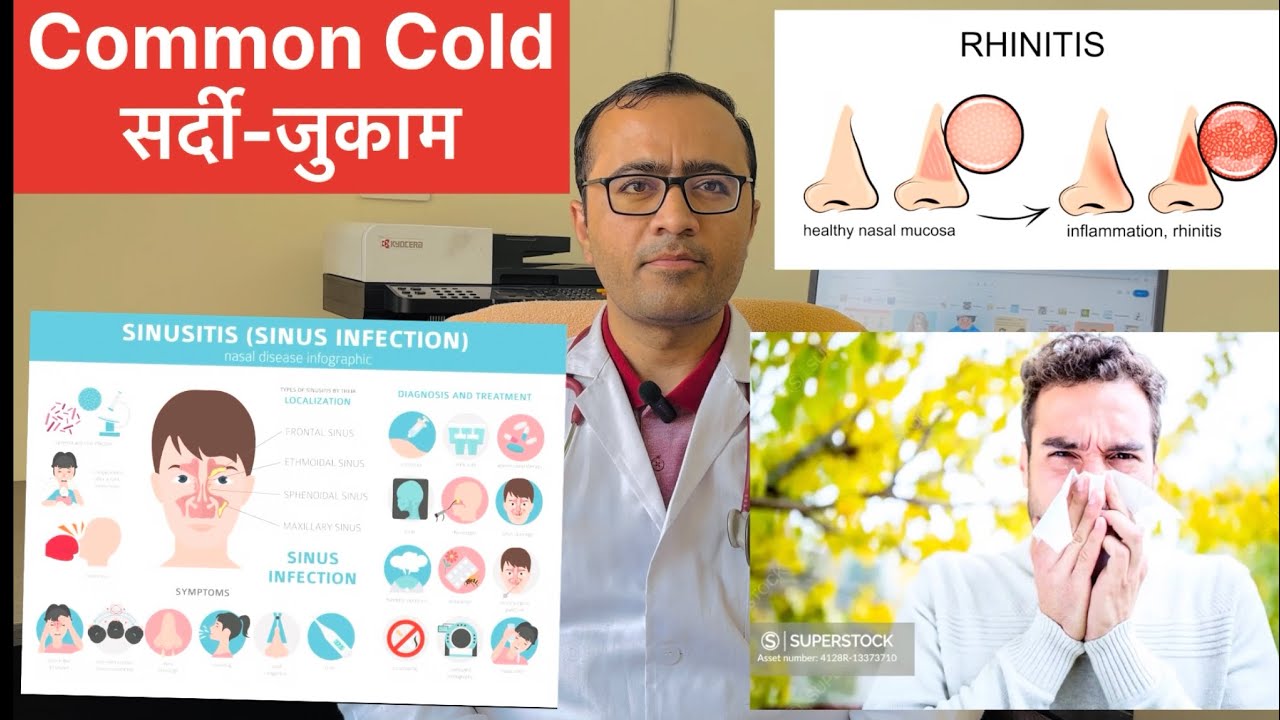 सामान्य जुकाम (Common Cold) का सही इलाज | Antibiotic कब दें? | Harrison Based Clinical Guide