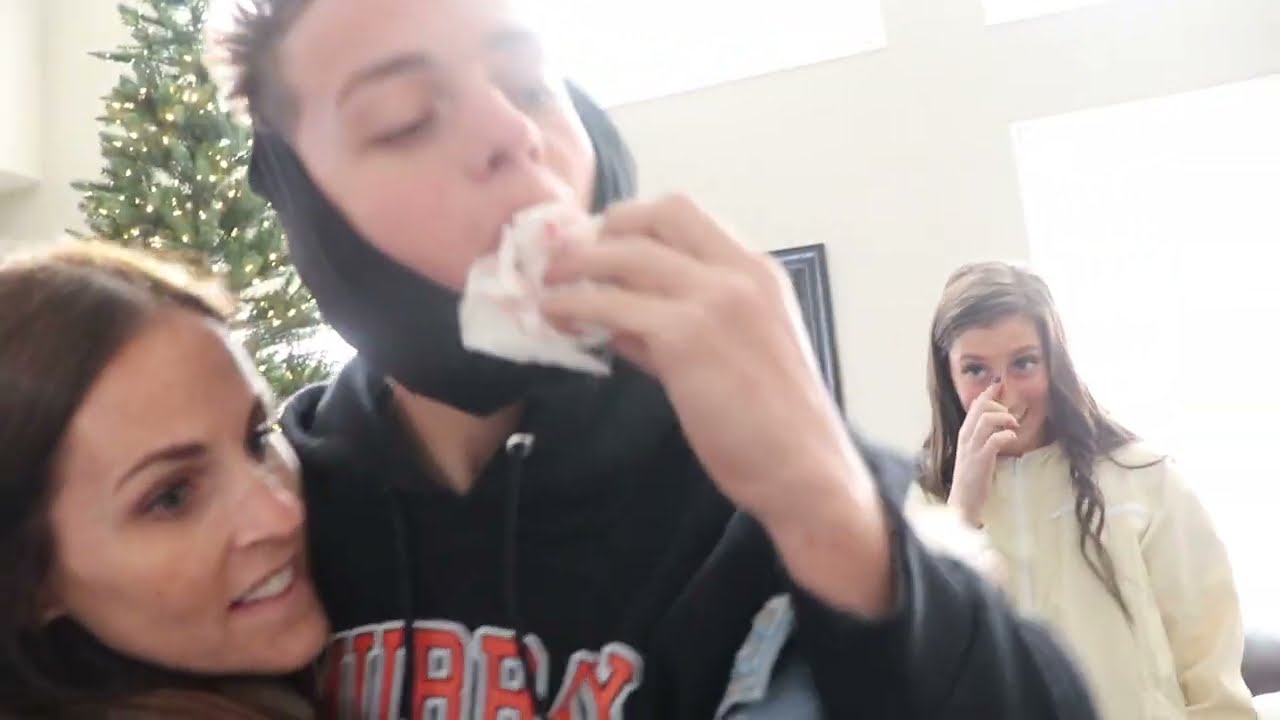 TWINS GET WISDOM TEETH OUT AT THE SAME TIME