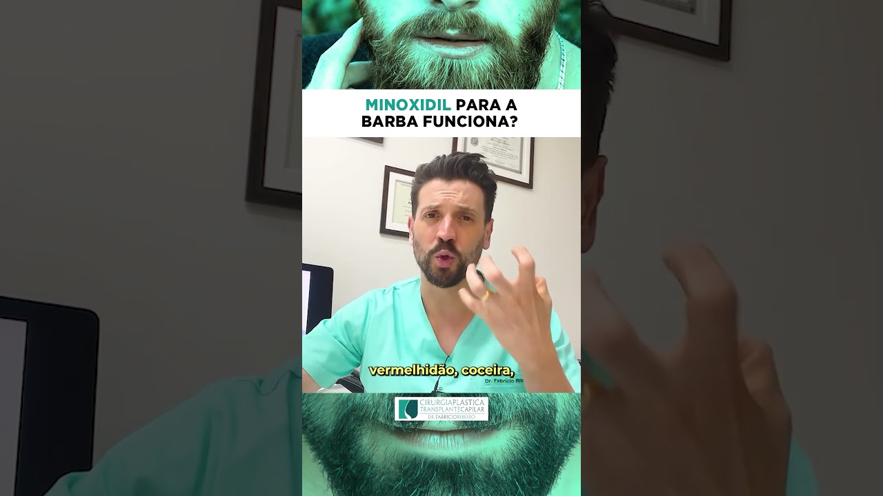 Minoxidil funciona para aumentar a barba ?